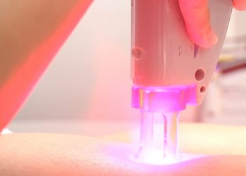 Advancements in the Medical Laser Industry
